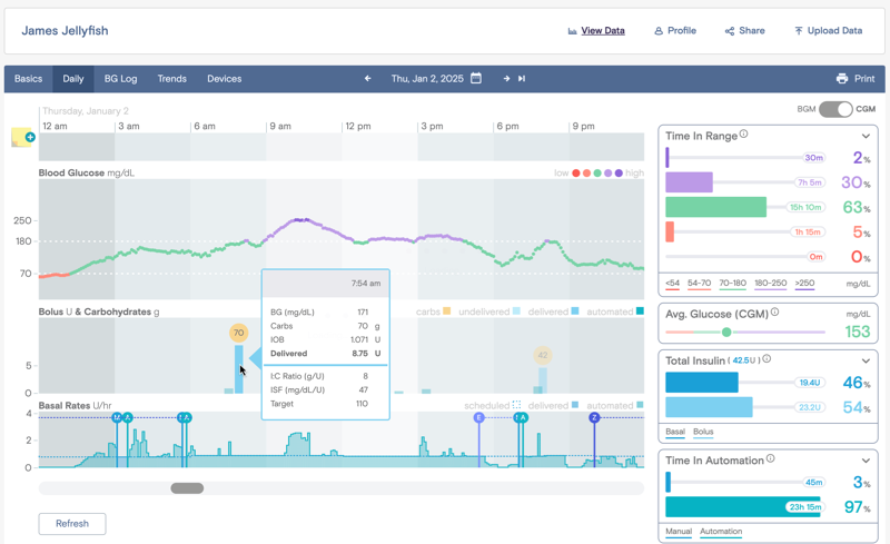 Daily view from Tidepool Web showing 24 hours of diabetes data from CGM and insulin pump. Stats on the right side of the page indicating time in range and insulin usage.