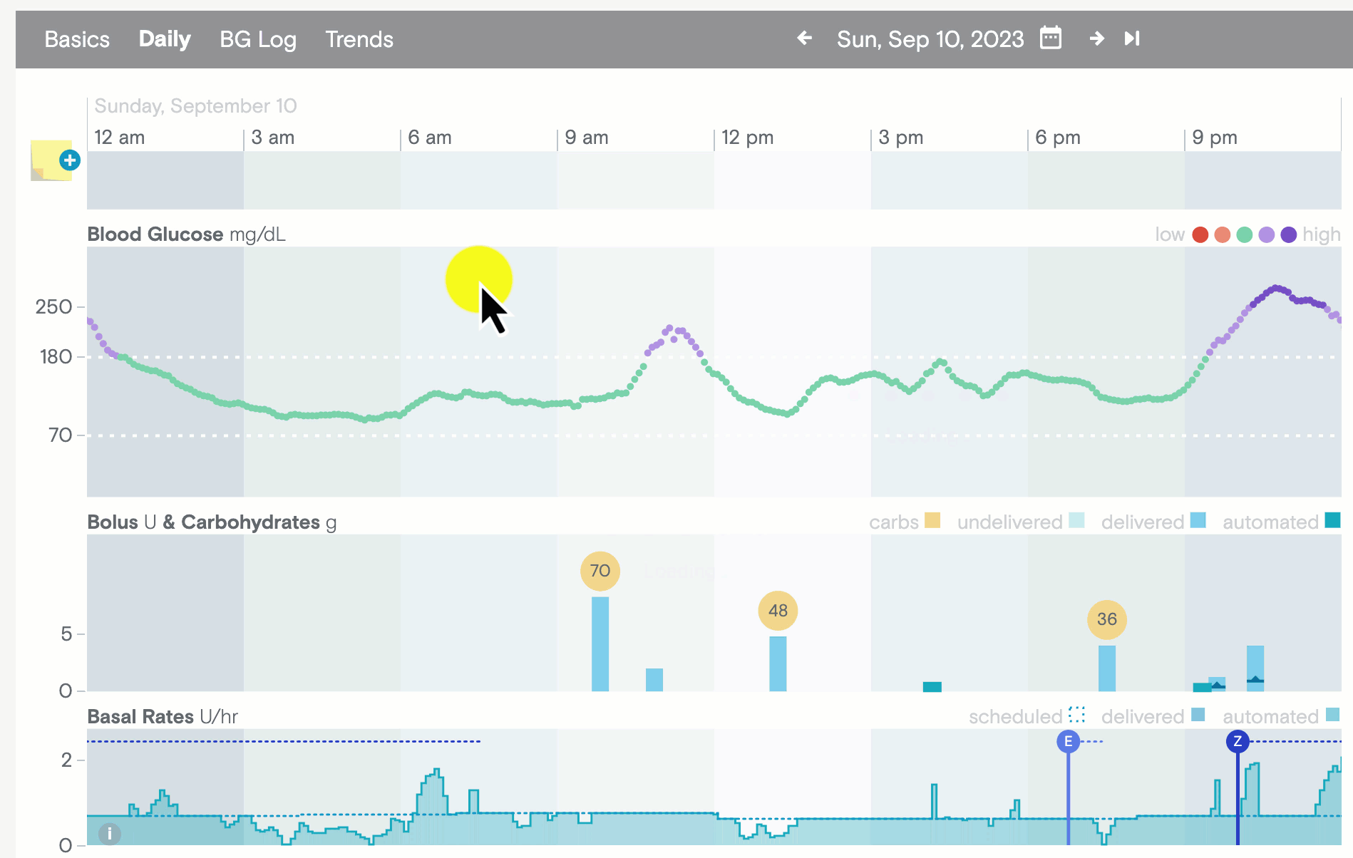 Animated GIF of creating a new note in Tidepool Web